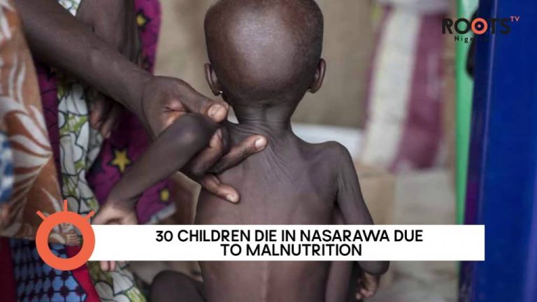 30 Children Dead, 2000 Hospitalized For Malnutrition